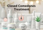 Closed Comedones Treatment