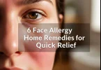 Home Remedies for Facial Allergies