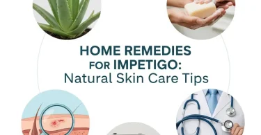 home remedies for impetigo