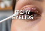 itchy eyelids
