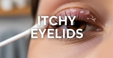 itchy eyelids