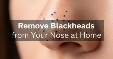 How to Remove Blackheads From Nose at Home