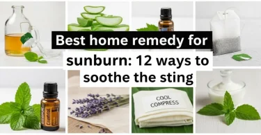 best home remedy for sunburn