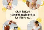 home remedies for skin rashes