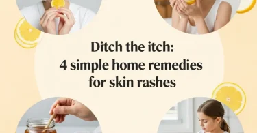 home remedies for skin rashes