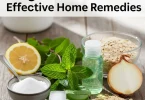 home remedy for itchy bug bites