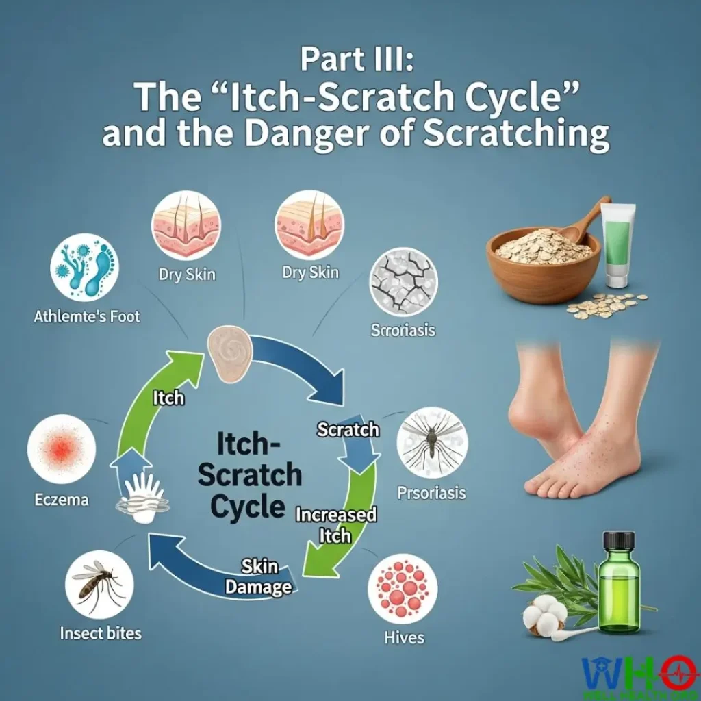 home remedies for itchy feet 3