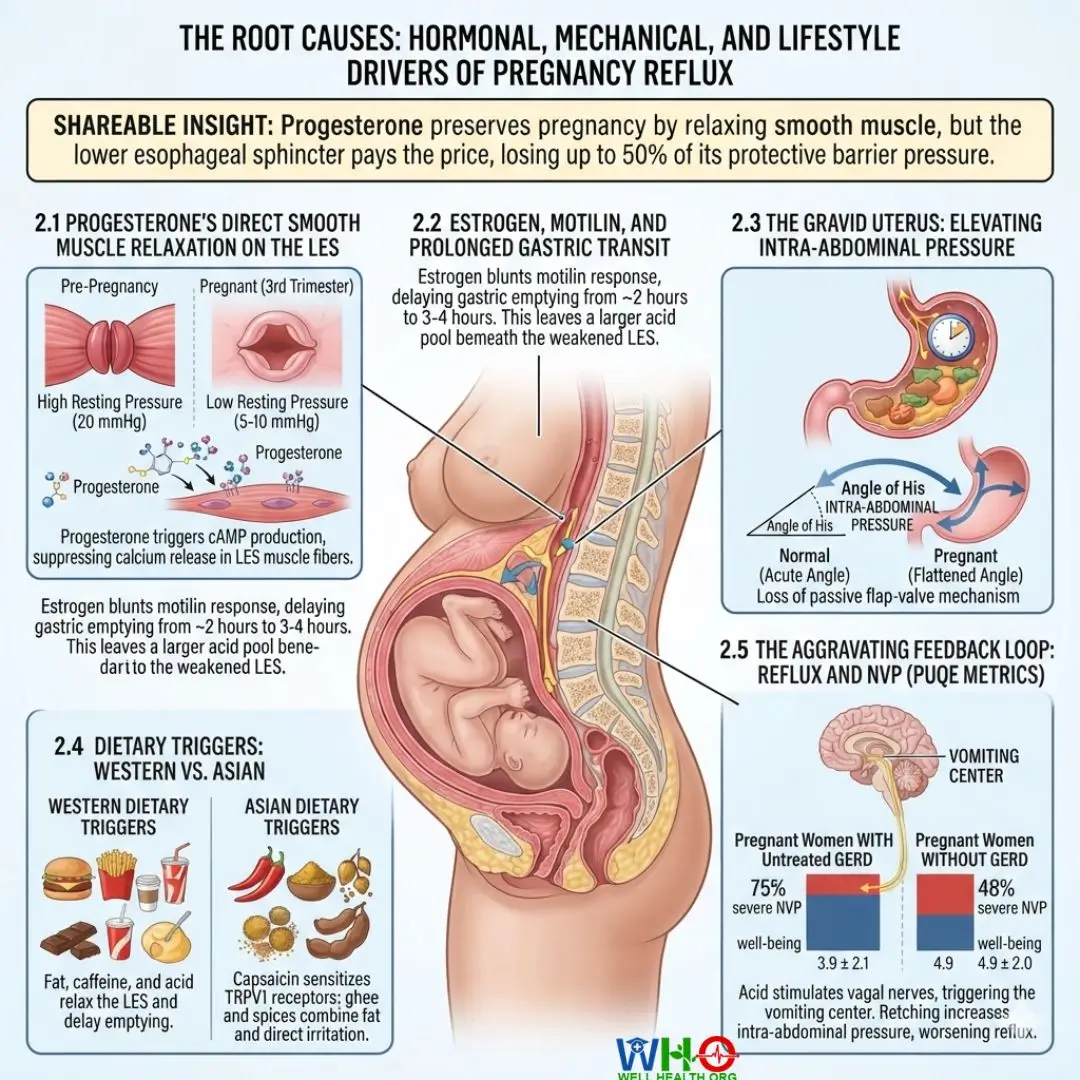 Soothing Severe Heartburn and Acidity in Pregnancy: A Clinical Treatment Protocol 3 Heartburn and Acidity in Pregnancy 2