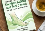 natural treatment for swollen ankles and feet